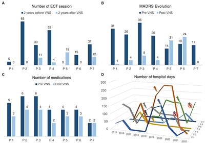 Vagus nerve stimulation allows to cease maintenance electroconvulsive therapy in treatment-resistant depression: a retrospective monocentric case series